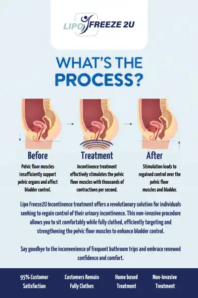 Diagram of how incontinence treatment Thame works.