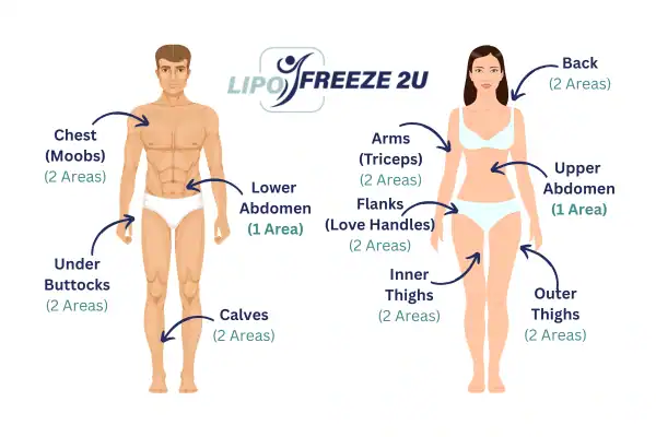Areas you can have fat freezing treatment Thame