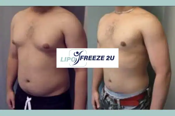 How Long Does It Take to See Results Thame?