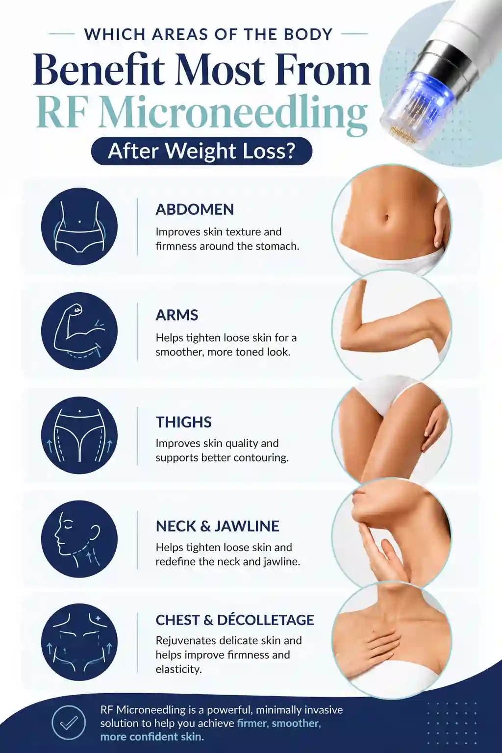 Which Areas of the Body Benefit Most From RF Microneedling After Weight Loss Thame